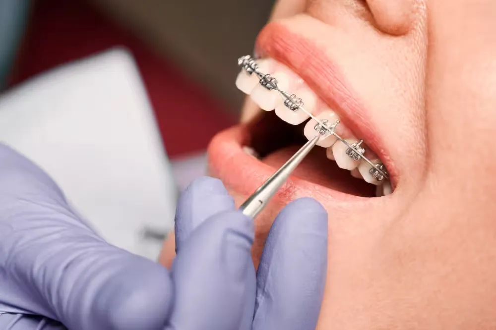 Personalized Orthodontic Treatment Plans Tailored to Your Needs